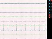 ¿Que hacemos ECG’s? posibilidad DICOM Waveform