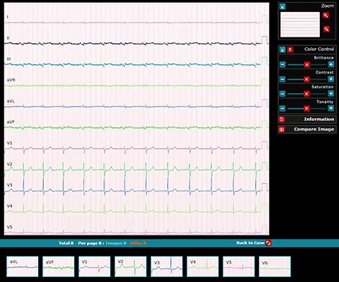 ¿Que hacemos con los ECG’s? La posibilidad de DICOM Waveform .