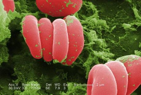 Transformar la sangre donada de diversos grupos sanguineos en sangre del mismo tipo universal.