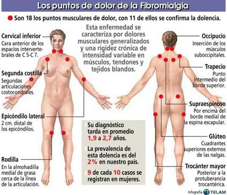 Hola, tengo Fibromialgia