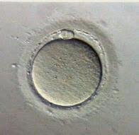 Número óptimo de ovocitos recuperados tras punción ovárica