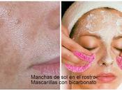 Mascarilla bicarbonato para quitar manchas