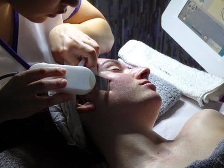 Resurfing facial en la Gesta/ Experiencia