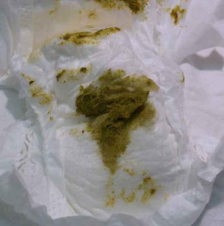 heces-definitivas-con-la_mamiclic