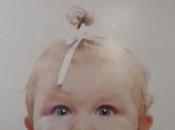 Problemas visión niños.Recomendaciones soluciones.