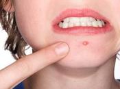 causa granos rojos piel como eliminarlos casa.