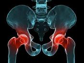 Transparencia producto sanitario: reciente caso prótesis