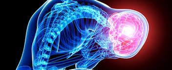 Un sencillo test te revela a cuanto riesgo estas de sufrir infarto cerebral cerebral