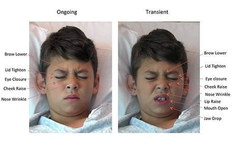 Software que evalúa objetivamente el nivel de dolor de los niños Medir el dolor de los niños