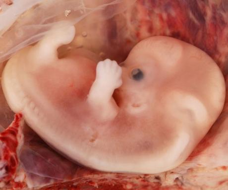 Depresión y embarazo