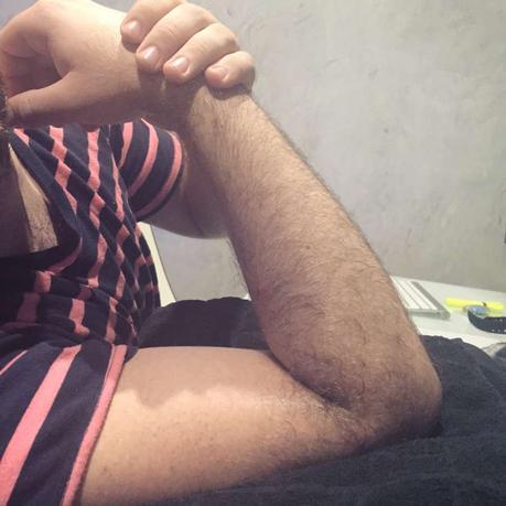 RECUPERACIÓN LUXACIÓN DE CODO Y FRACTURA DE LAS CORONOIDES DEL CÚBITO II IMG_3740