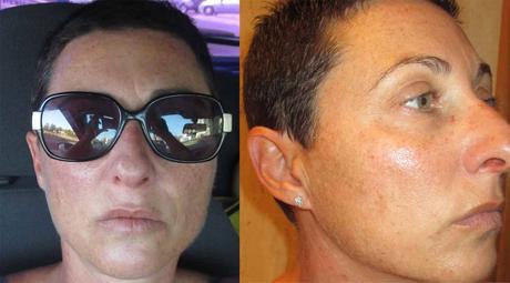 Icy pleasure Tratamiento facial reparador after-sun de Germaine de Capuccini