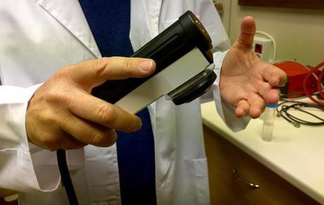 Diagnostico de meningitis