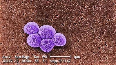 Staphylococcus aureus resistente a la meticilina Methicillin-resistant Staphylococcus aureus mrsa