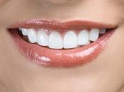 Razones para Blanquear Dientes