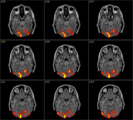 El momento exacto en que tu cerebro «graba» un recuerdo El momento exacto en que tu cerebro «graba» un recuerdo