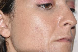 ANTHELIOS XL BB cream LA ROCHE POSEY