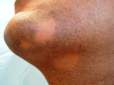 farmaceuticainmavinue