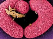 Elige bien comensal... Bacillus cereus