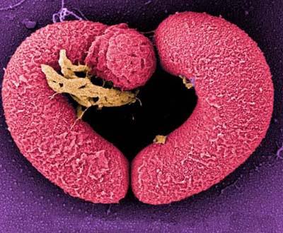Elige bien a tu comensal... hoy con Bacillus cereus