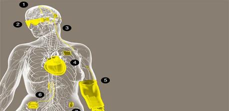 8 Implantes que parecen del futuro