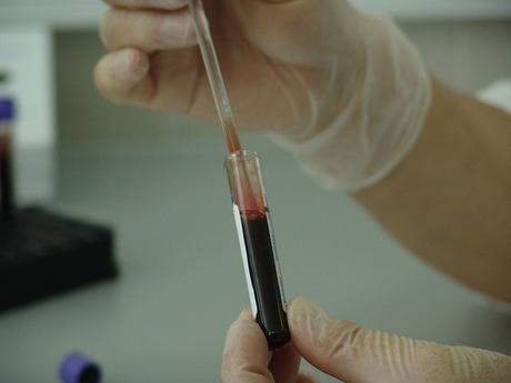 Científicos crean neuronas a partir de muestras de sangre