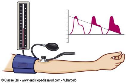 Divergencias entre guías de 2013 y 2014 de la hipertensión arterial. Posición  de la Sociedad Centroamericana y del Caribe de Hipertensión y Prevención Cardiovascular