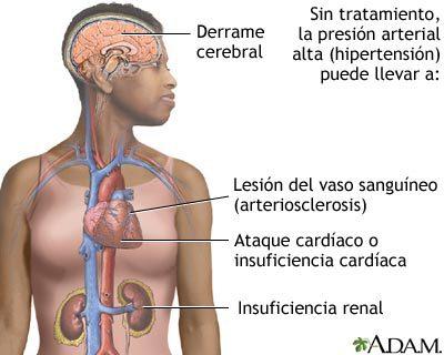OPS/OMS advierten sobre el control de la hipertensión arterial