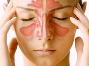 ¿Tengo infección senos paranasales? Cómo reconocer Sinusitis