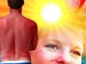 Prolongada Exposición puede dañar Ojos