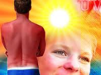 Una Prolongada Exposición al Sol puede dañar los Ojos