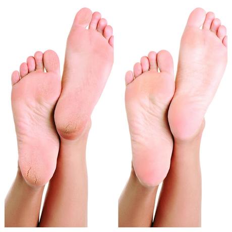 La Pedicura Que Te Puedes Llevar De Vacaciones