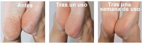 MICRO.Pedi de Emjoi. Pedicura Profesional En Casa