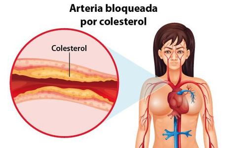 FDA aprueba revolucionario fármaco contra el colesterol