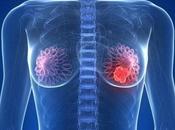 Nueva estrategia farmacológica ante tumor mama HER2
