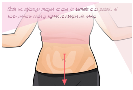 perdidas orina_mamiclic