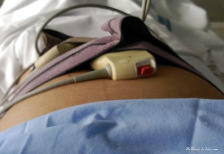 monitores embarazo preeclampsia sobre mi embarazo