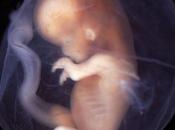 muerte fetal incrementa cuatro veces riesgo sufrir otra próximo embarazo