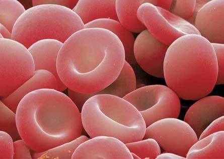 Karl Landsteiner y las rarezas de los grupos sanguíneos