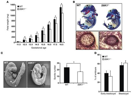 Diana potencial para el tratamiento de la diabetes tipo 2