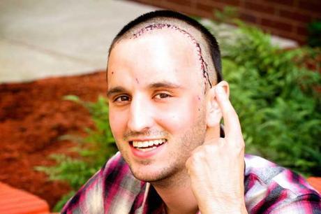 steven keating El estudiante que filmó su propia cirugía cerebral
