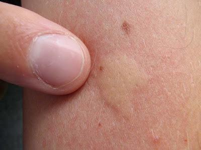 farmaceuticainmavinue