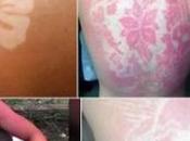 Tatuajes