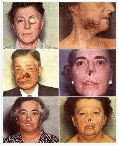 Efectos del Tricho System en el organismo