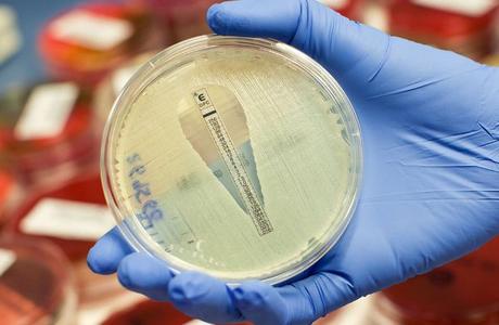 Uso incorrecto de antibióticos por diagnósticos erróneos