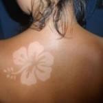 sunburn-art-noticias-totenart-flor