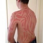 sunburn-art-noticias-totenart-lineas