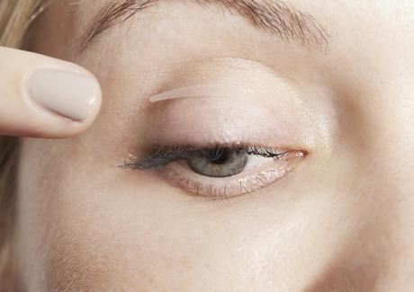 Lifting de Párpados Sin Cirugía con Magicstripes