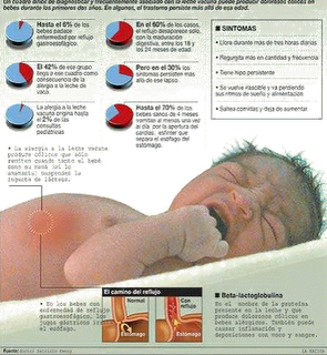 El reflujo gastroesofágico