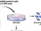 Neuronas Funcionales pueden curar Autismo